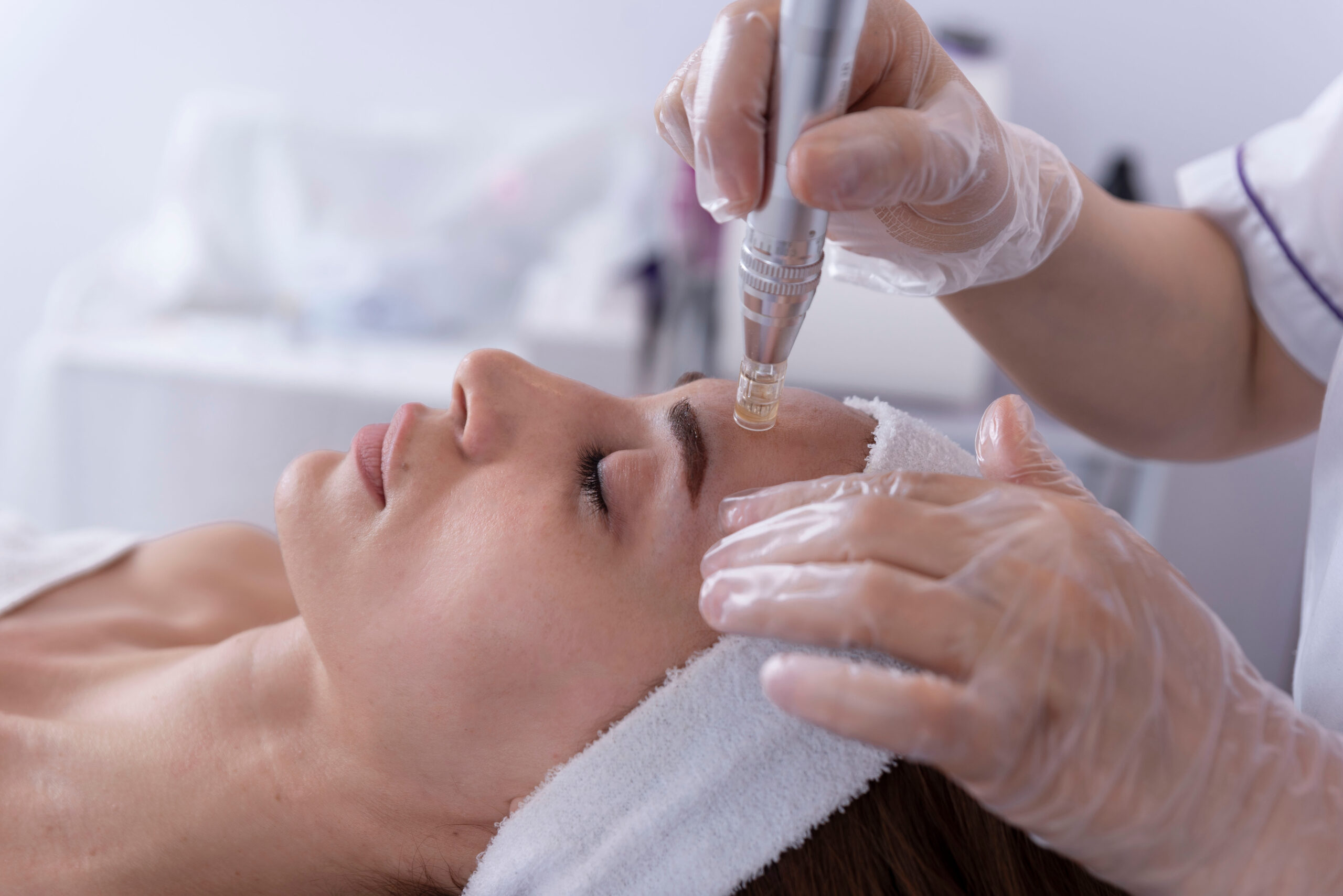 close up of Cosmetologist,beautician applying facial dermapen tr microneedling1 scaled - Microneedling